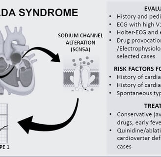 Brugada Syndrome