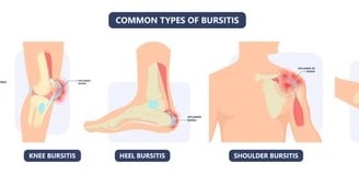 borsitis