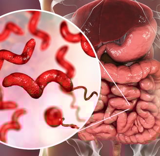 Campylobacter infection