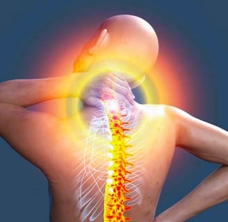 fibromyalgia