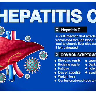 hepatitis c