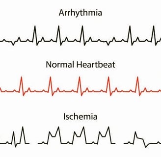 Heart Rate
