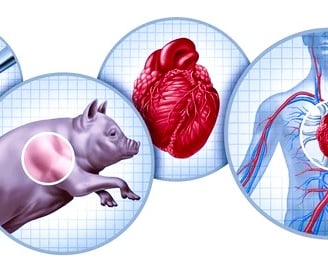 Heart Transplants