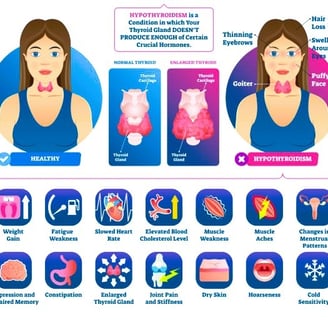 Hypothyroidism