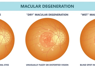 macula
