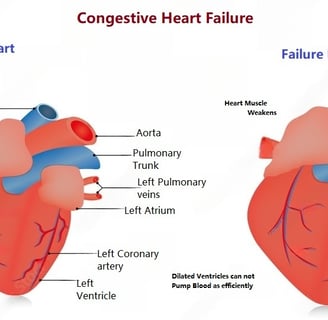 healthy and failure heart