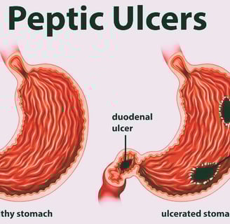 peptic ulcers