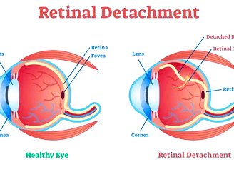 retina