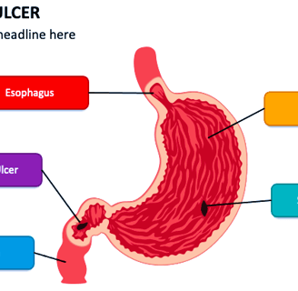 ulcer