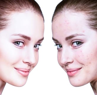 Winter Skin Care