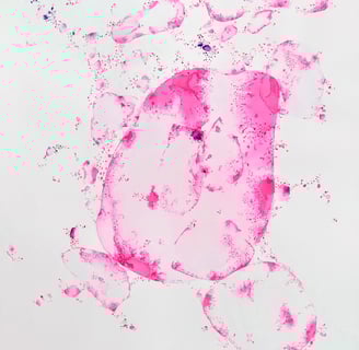 Peinture abstraite rose fluo cellules de vie