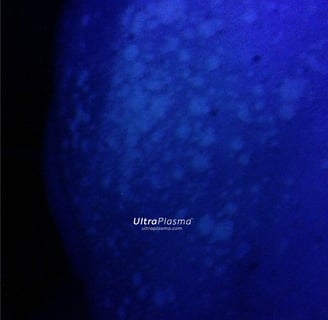 ultraplasma.com Tinea Versicolor woodlamp diagnosis
