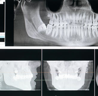 Dental dataset