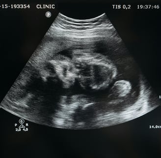 Meteral and fetal growth dataset