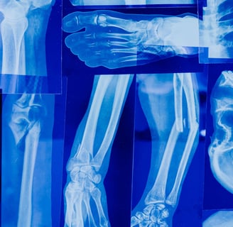 Xray dataset