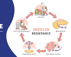 Brain Insulin: The Secret Weapon for Weight Management, Mood & Brain Health (
