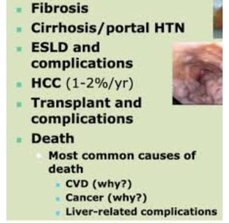 _Beware of the inevitable fate of fatty liver,fibrosis , cirrhosis, esophageal varices and hepatoma