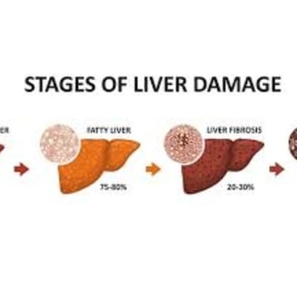cirrhosis, esophageal varices and hepatoma