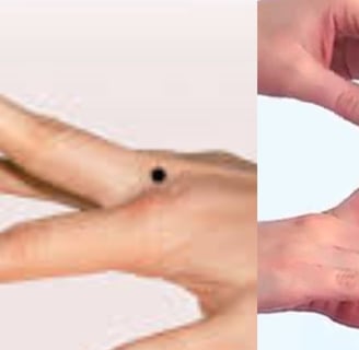 🤲 Trigger Finger & the Role of Voluntary Fasting: A Natural Healing Approach