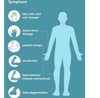 neuropathy symptoms