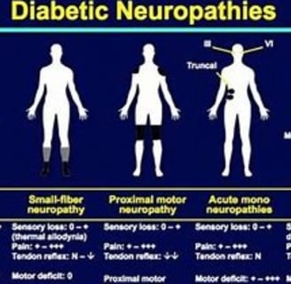 diabetic neuropath