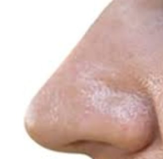 _🧠👃 The Nose Knows Exploring the Strange Smell Linked to Cancer