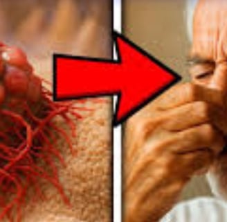 _🧠👃 The Nose Knows Exploring the Strange Smell Linked to Cancer