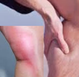 💧🩺 Why doesn’t dehydration during voluntary fasting lead to dangerous blood clots? Discover how th