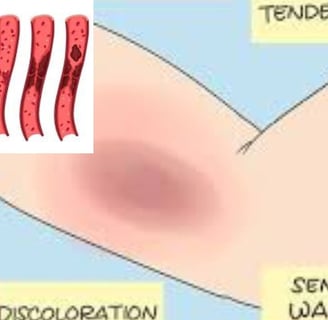 💧🩺 Why doesn’t dehydration during voluntary fasting lead to dangerous blood clots? Discover how th
