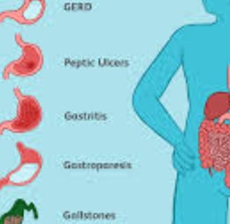 Emesis and Upper Digestive Tract Blockages