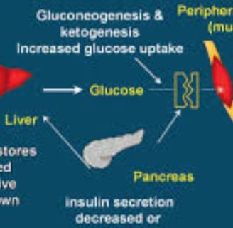 Is Fasting Superior to Medication in Diabetes Management?