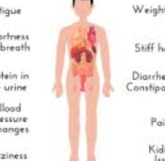 amylodosis all over the body