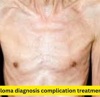 a male patient with multiple myoloma