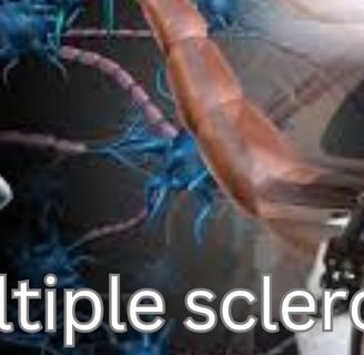 multiple sclerosis