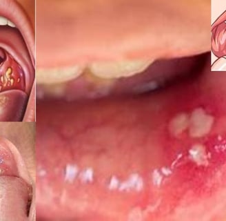 throat inflamtion
