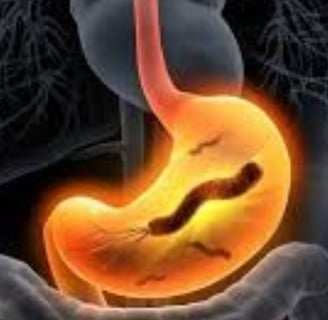 The Impact of Microbiome, Fasting, and Probiotics on Cancer (4)