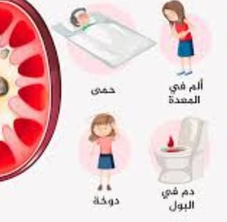 انسداد الحصوة الاعراض