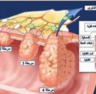 فيمكن أن يكون طفيفًا أو موجعًا أو حادًّا أو حارقًا. ويمكن أن يكون ثابتًا أو متقطعًا أو معتدلًا أو مت