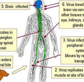 brain infection