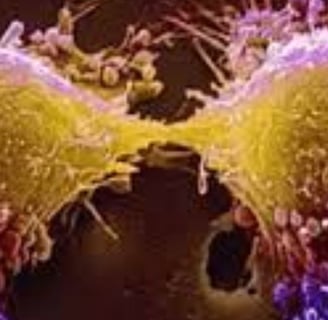 Fasting in Tumor Lysis Syndrome