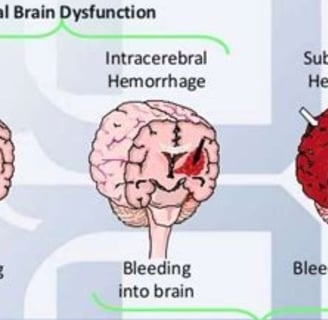 stroke types