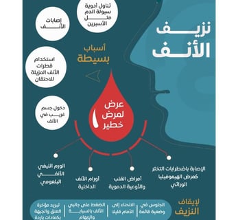 اسباب النزف كيف تدير نزيف الانف :علاج نزيف الانف الخلفي بالعسل والمضمضة