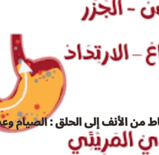 إفرازات الأنف الخلفية الناجمة عن داء الجزر المعدي المريئي