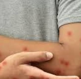 A warning sign of diabetes (5)
