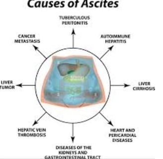 Abdominal Paracentesis causes