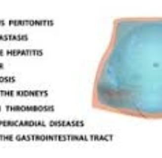 causes of ascitis