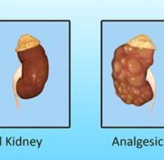 nephropathy