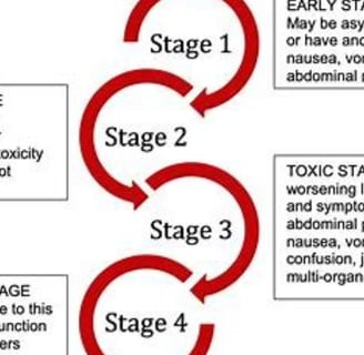 stages
