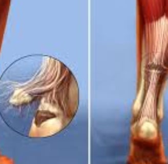 achilles tendon