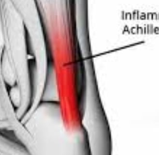 achilles tendon